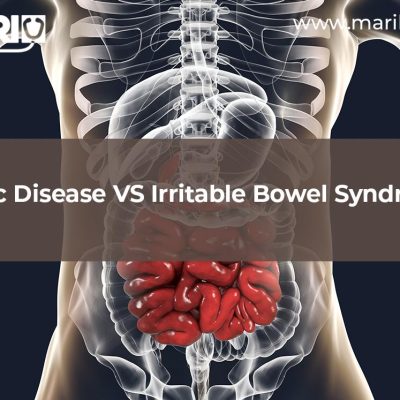 Misdiagnosis of Irritable bowel syndrome vs. Celiac disease